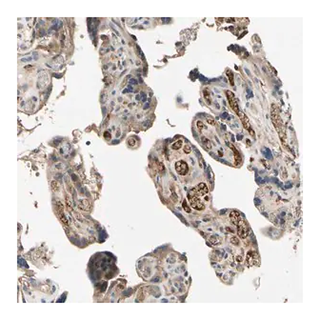 Merck Anti-IL1RL1 antibody produced in rabbit