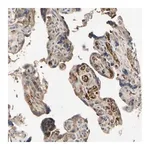 Merck Anti-IL1RL1 antibody produced in rabbit