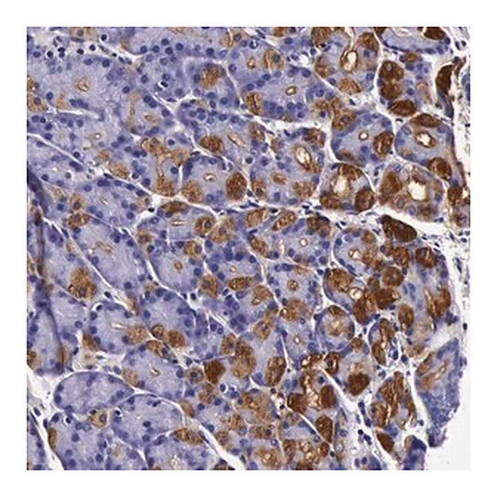 Merck Anti-CCDC22 antibody produced in rabbit