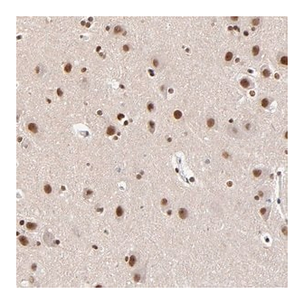 Merck Anti-ZMYM3 antibody produced in rabbit
