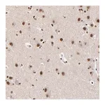 Merck Anti-ZMYM3 antibody produced in rabbit