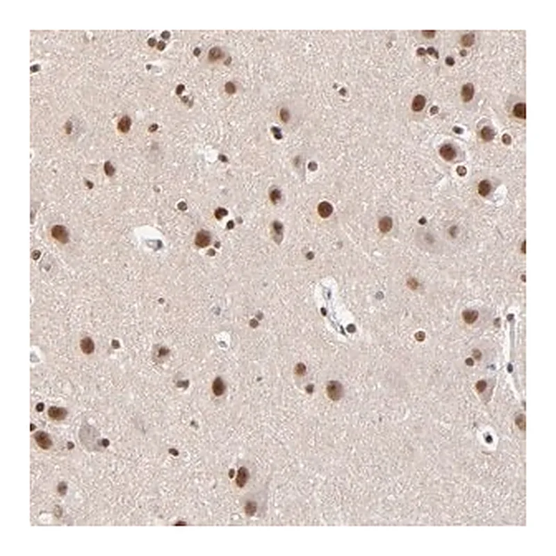 Merck Anti-ZMYM3 antibody produced in rabbit