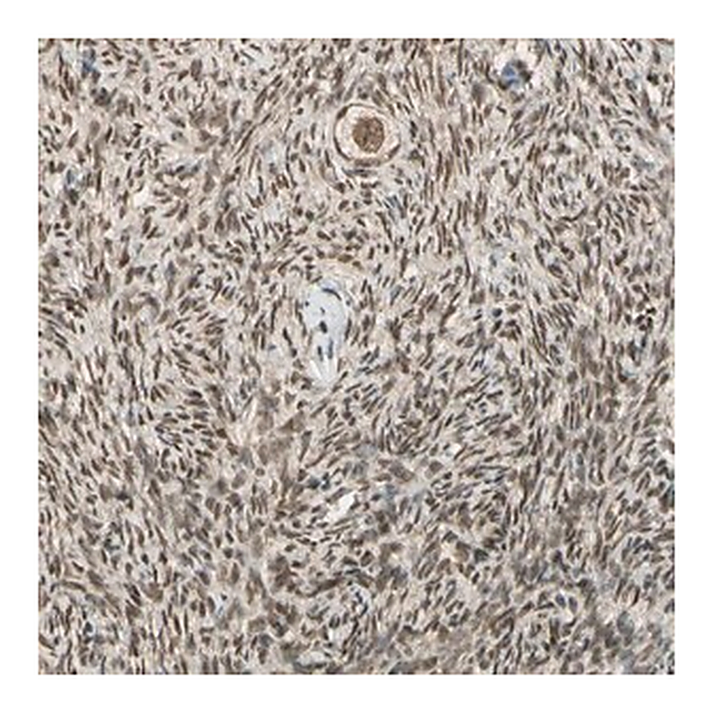 Merck Anti-ZNF135 antibody produced in rabbit