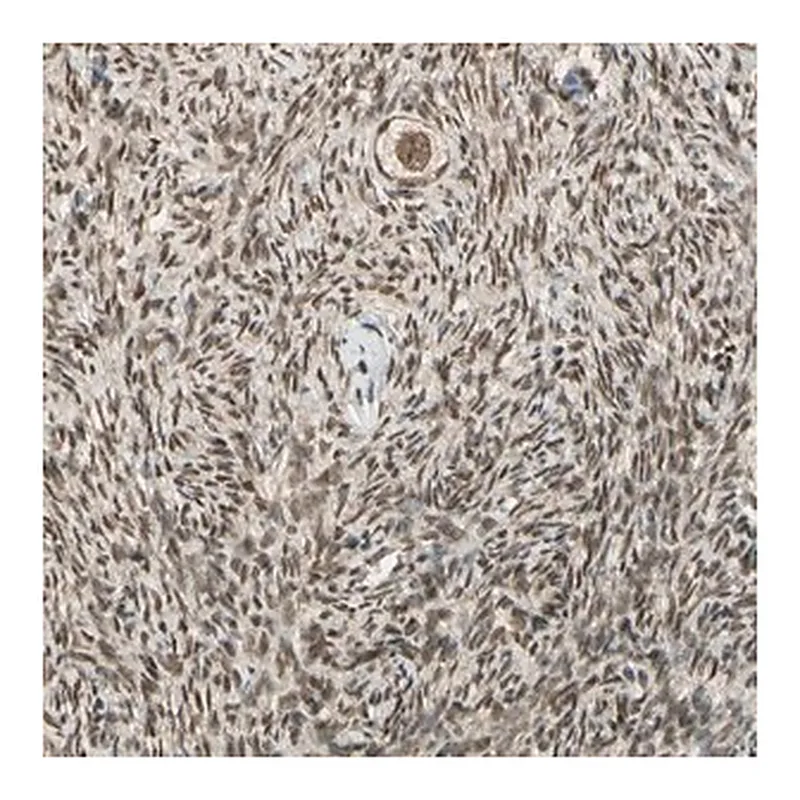 Merck Anti-ZNF135 antibody produced in rabbit