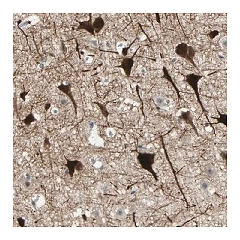 Merck Anti-ZKSCAN1 antibody produced in rabbit