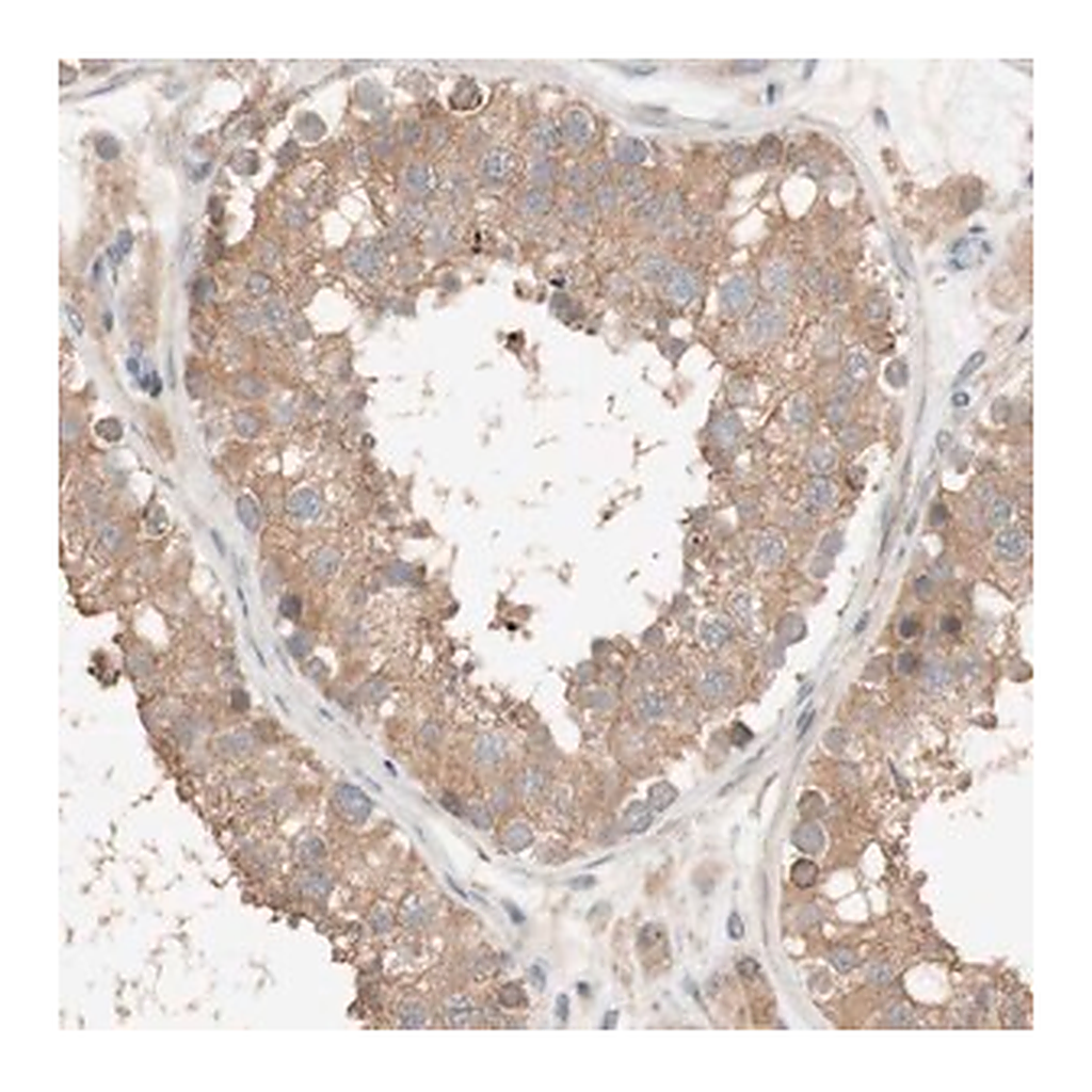 Merck Anti-DEUP1 antibody produced in rabbit