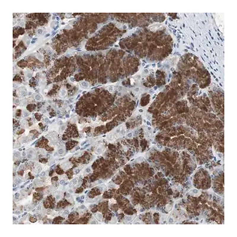 Merck Anti-ADNP2 antibody produced in rabbit
