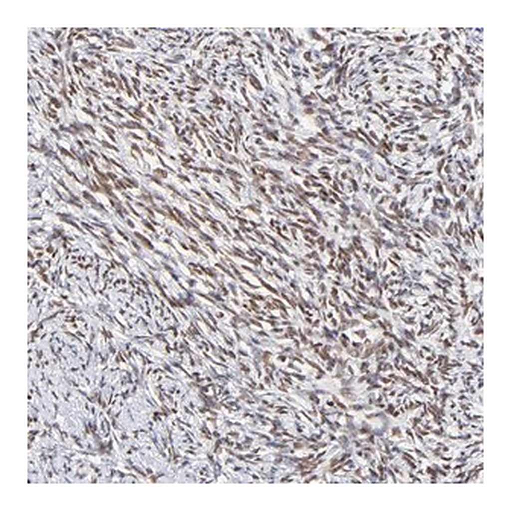 Merck Anti-ZNF74 antibody produced in rabbit