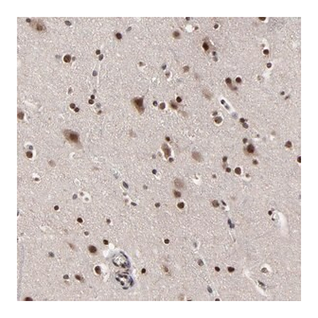 Merck Anti-ZNF777 antibody produced in rabbit