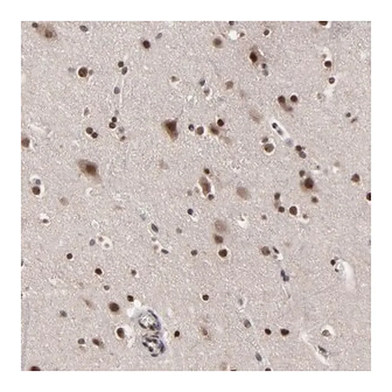 Merck Anti-ZNF777 antibody produced in rabbit