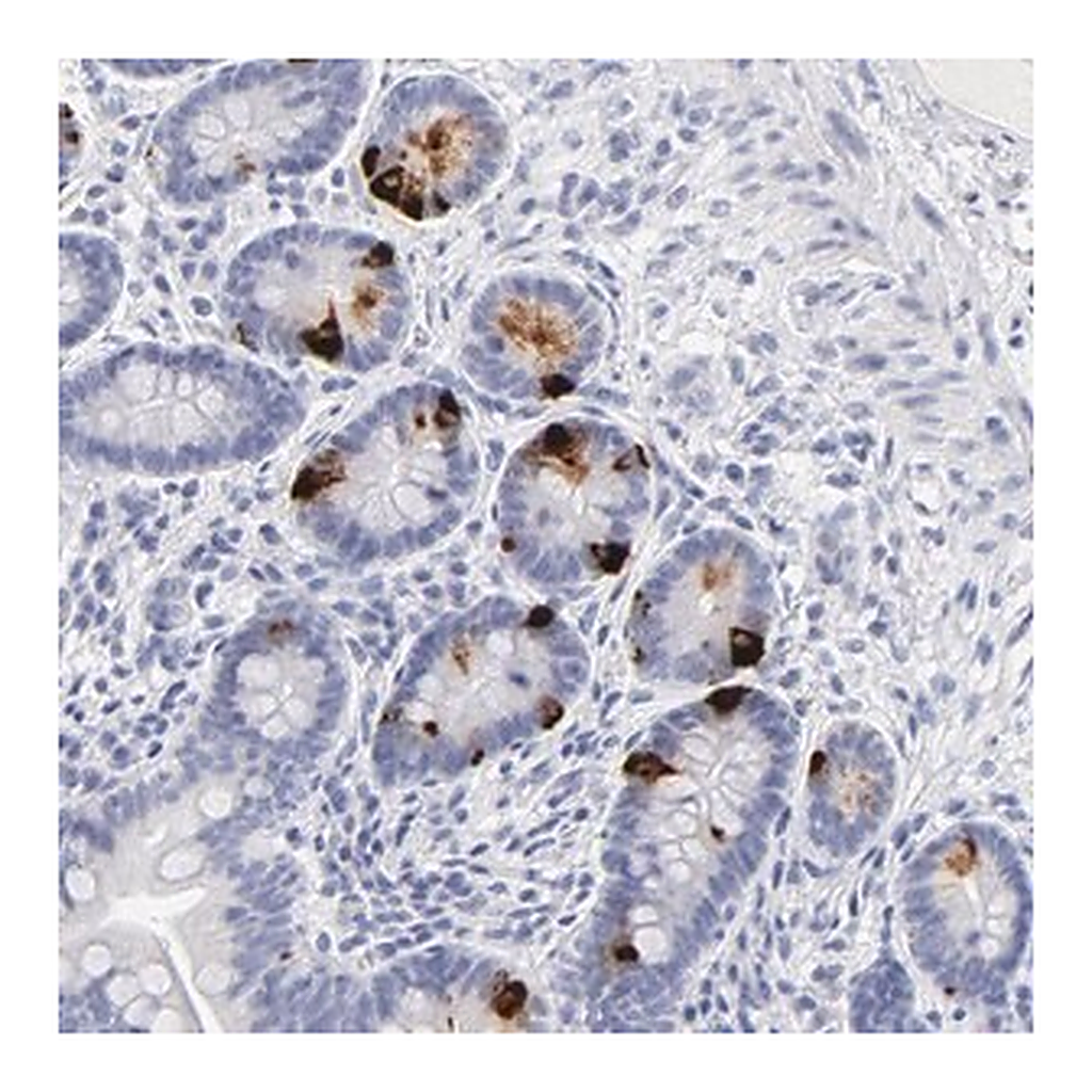 Merck Anti-KHNYN antibody produced in rabbit