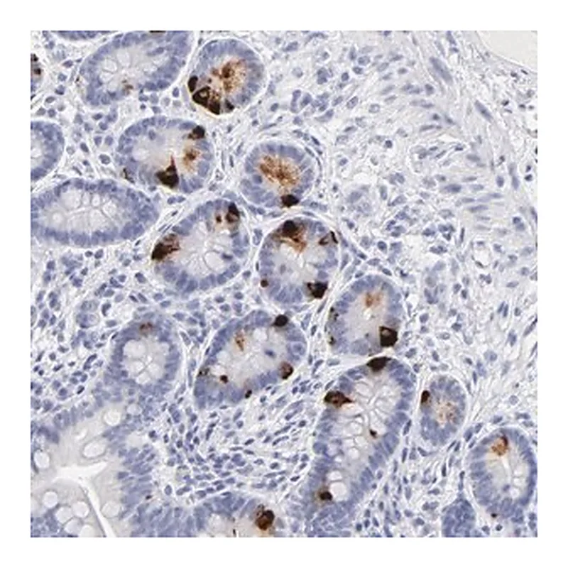 Merck Anti-KHNYN antibody produced in rabbit