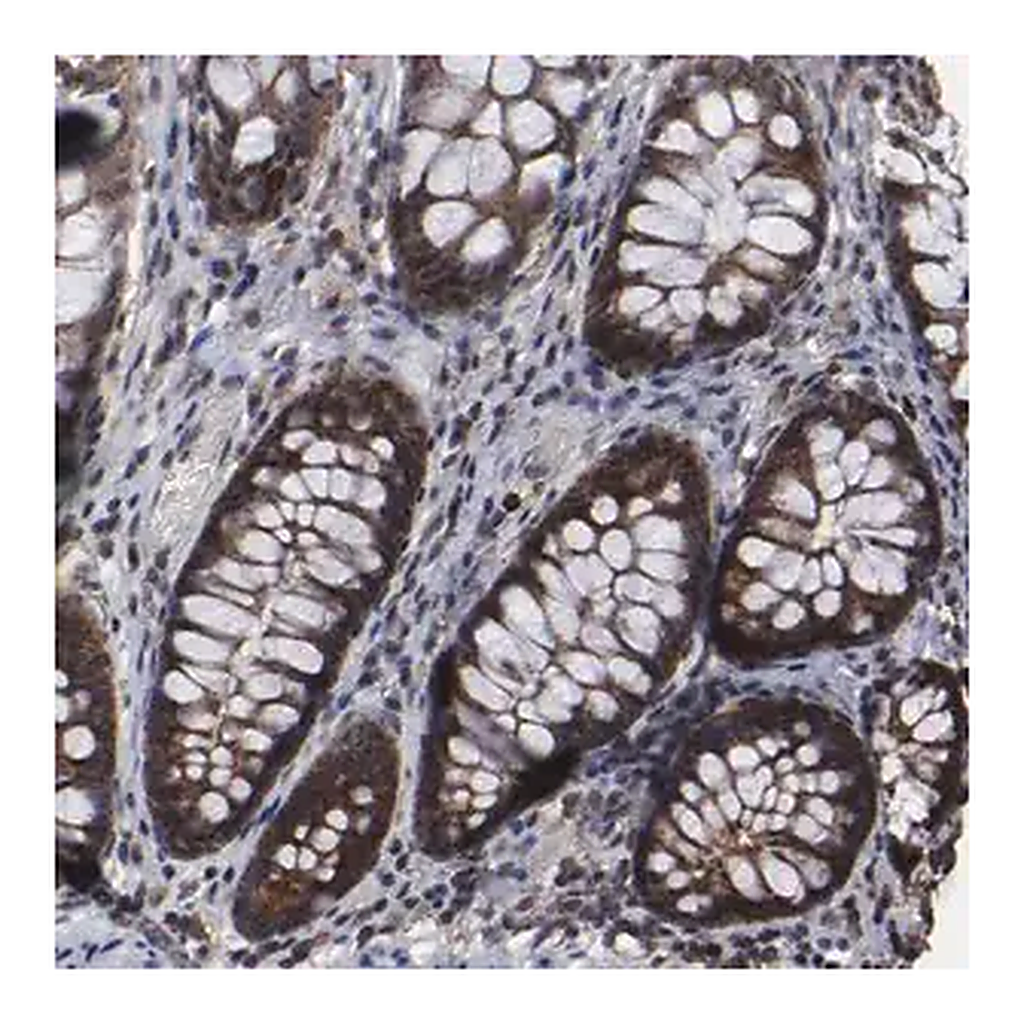 Merck Anti-KIAA2026 antibody produced in rabbit