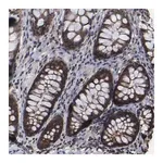 Merck Anti-KIAA2026 antibody produced in rabbit