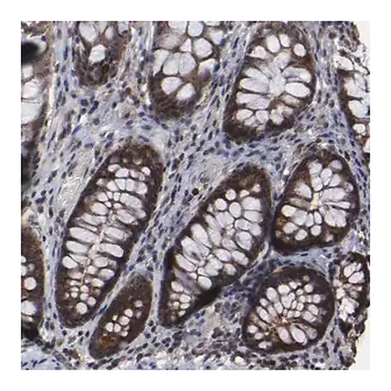Merck Anti-KIAA2026 antibody produced in rabbit