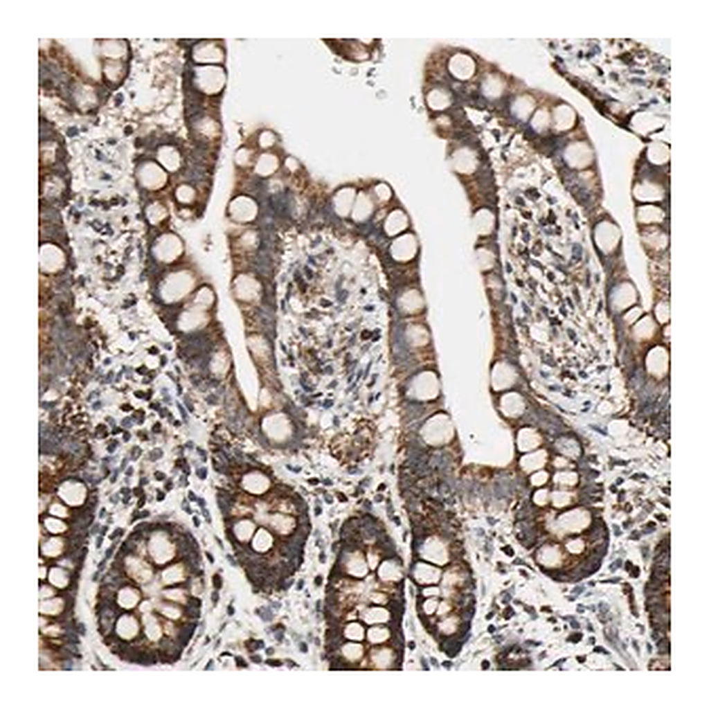 Merck Anti-KIAA0907 antibody produced in rabbit