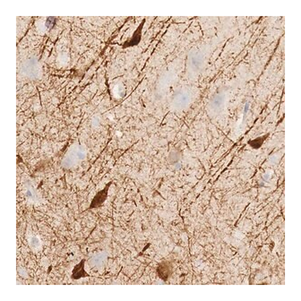Merck Anti-KLHDC7B antibody produced in rabbit
