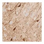 Merck Anti-KLHDC7B antibody produced in rabbit
