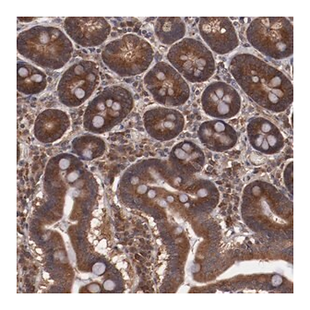 Merck Anti-TXNDC16 antibody produced in rabbit