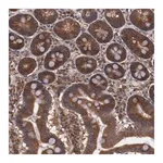 Merck Anti-TXNDC16 antibody produced in rabbit