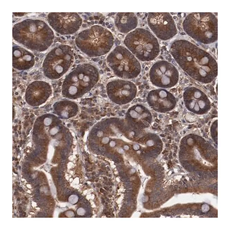 Merck Anti-TXNDC16 antibody produced in rabbit
