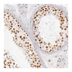 Merck Anti-RBMY1A1 antibody produced in rabbit