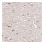 Merck Anti-REPS2 antibody produced in rabbit