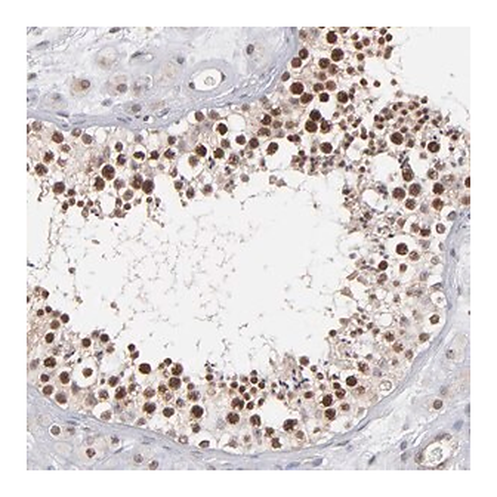Merck Anti-RGS6 antibody produced in rabbit