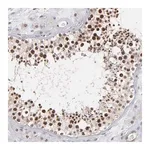 Merck Anti-RGS6 antibody produced in rabbit