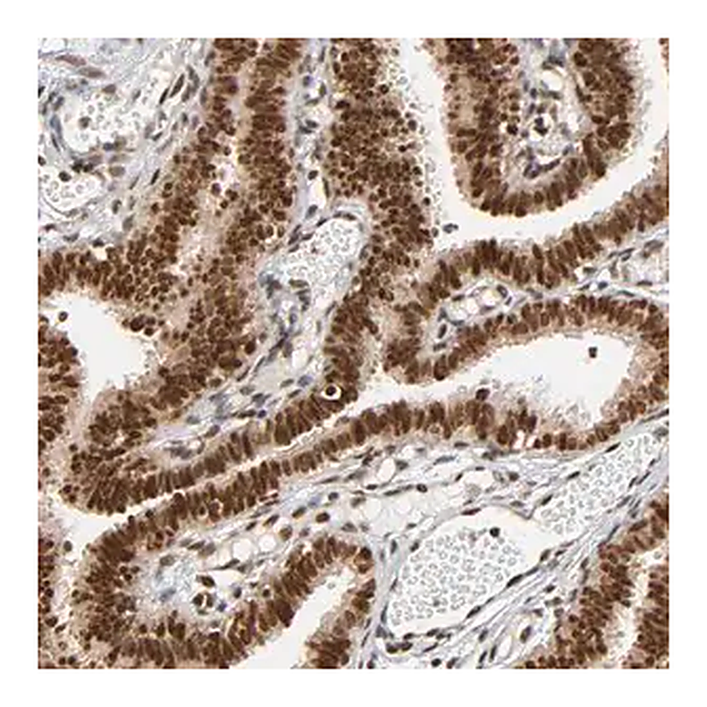 Merck Anti-RNF122 antibody produced in rabbit