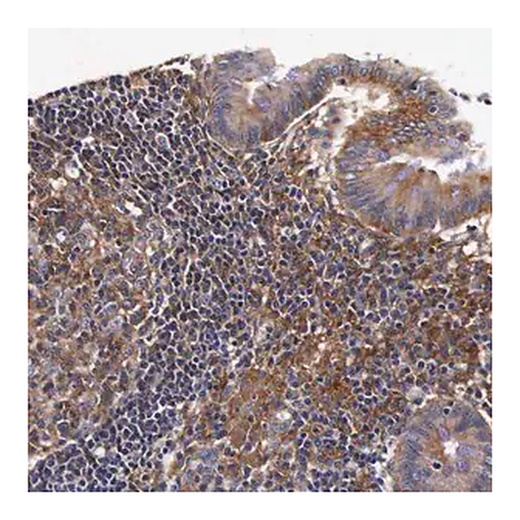 Merck Anti-RP2 antibody produced in rabbit