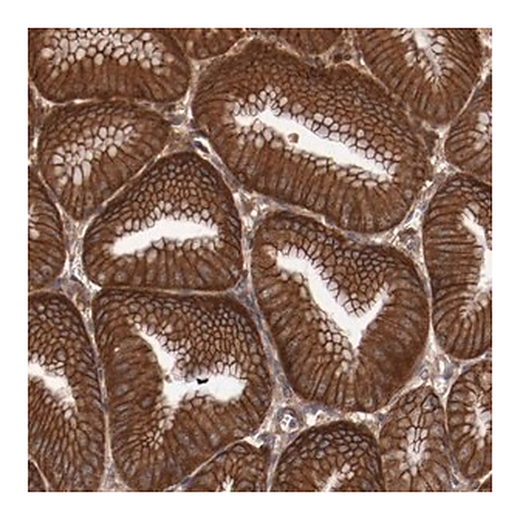 Merck Anti-RPS6KA6 antibody produced in rabbit