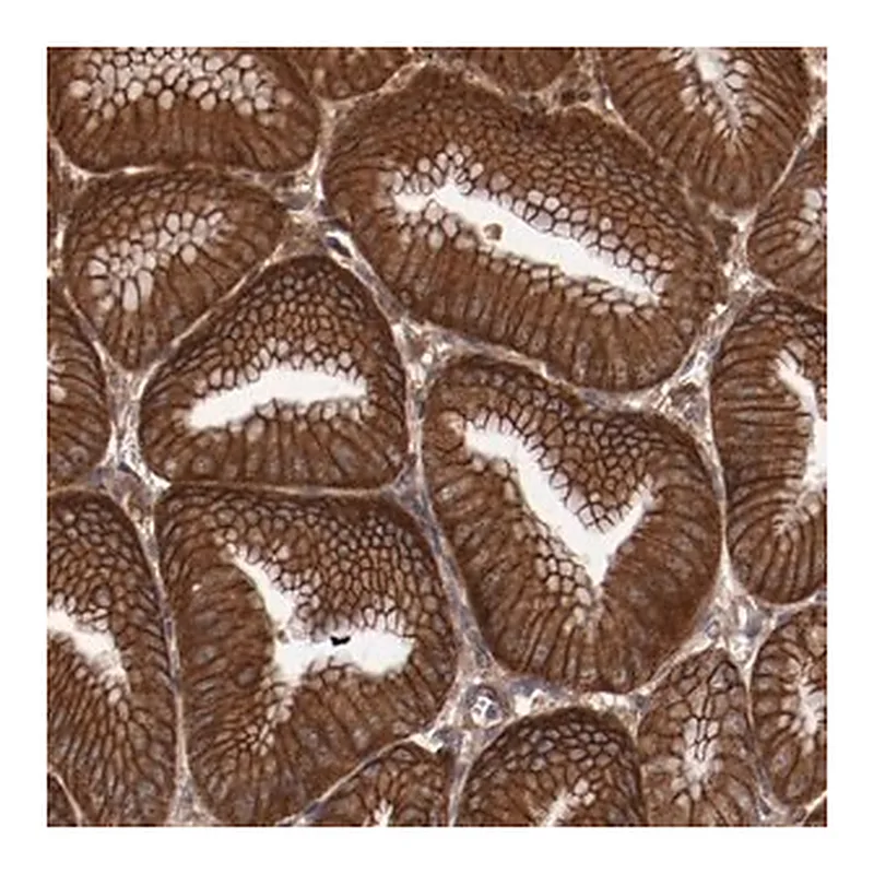 Merck Anti-RPS6KA6 antibody produced in rabbit