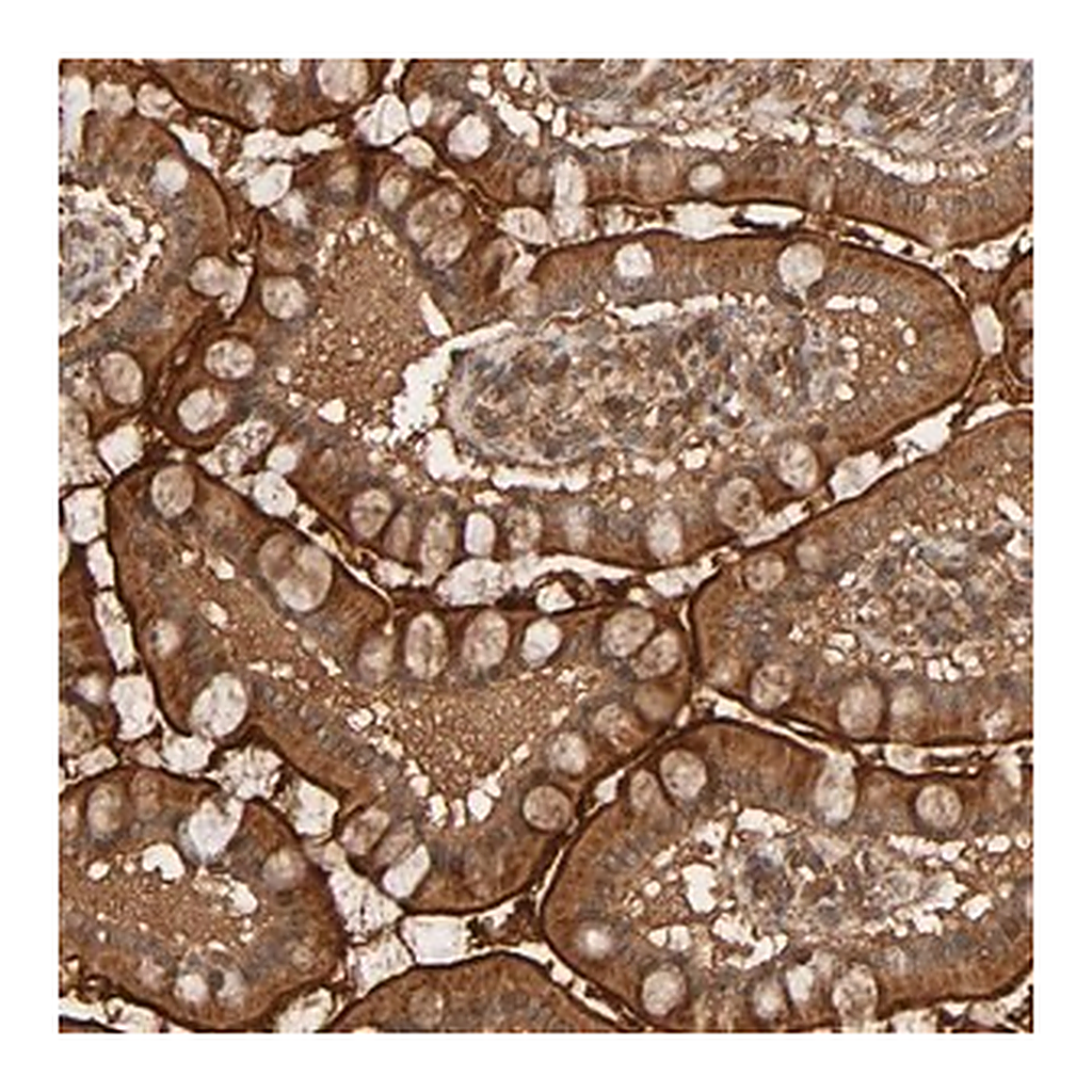 Merck Anti-RPS6KA6 antibody produced in rabbit