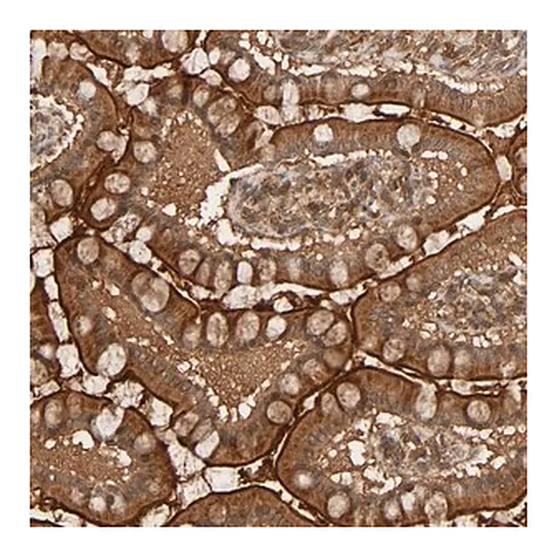 Merck Anti-RPS6KA6 antibody produced in rabbit