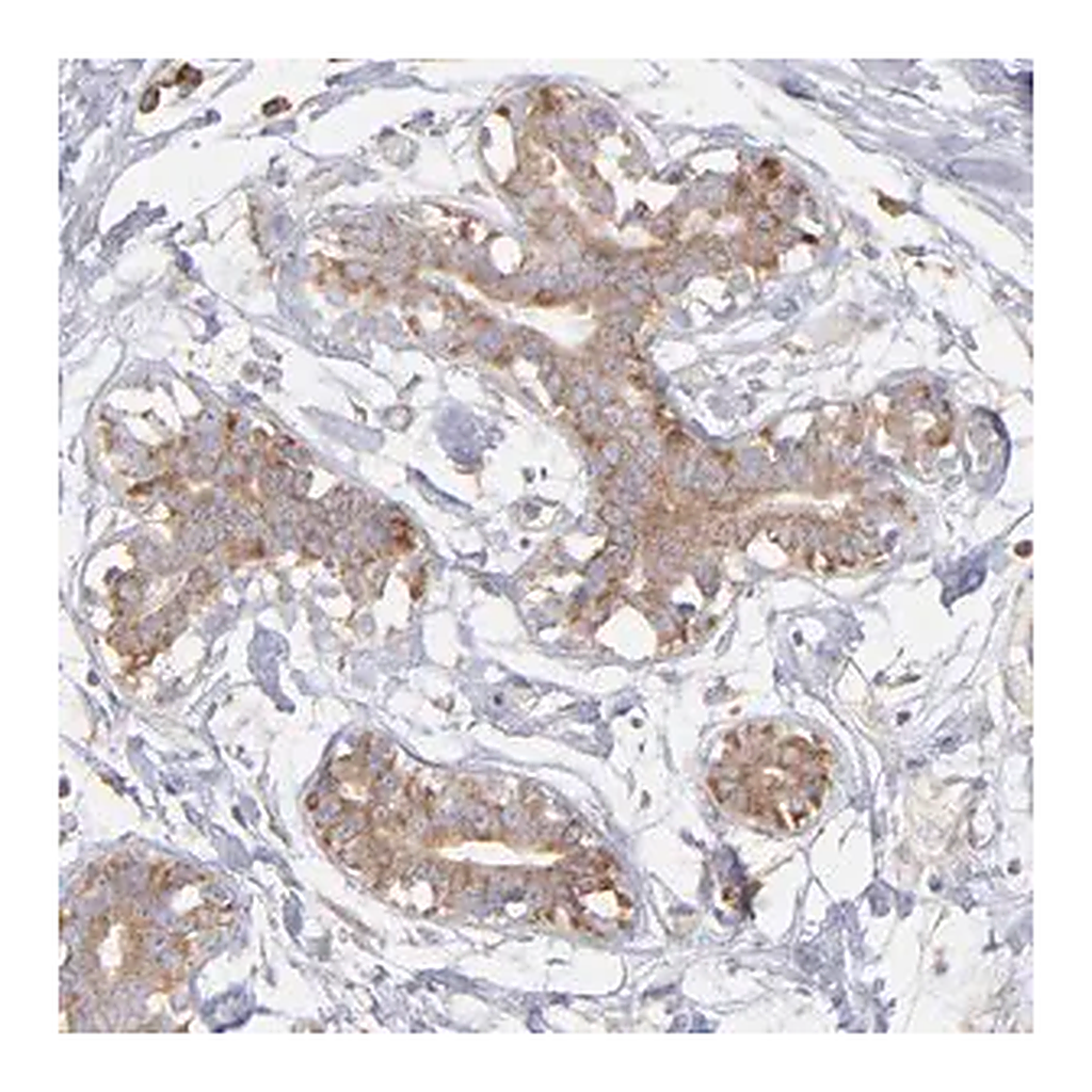 Merck Anti-RPLP0 antibody produced in rabbit