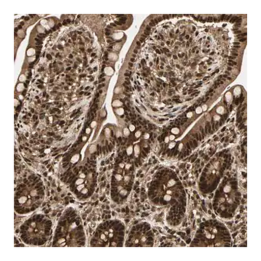 Merck Anti-ZSCAN30 antibody produced in rabbit