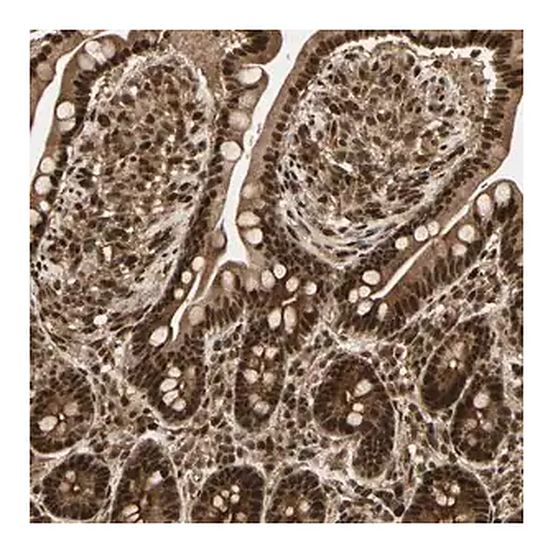 Merck Anti-ZSCAN30 antibody produced in rabbit