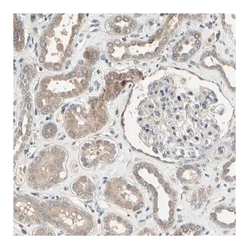 Merck Anti-SNX29 antibody produced in rabbit