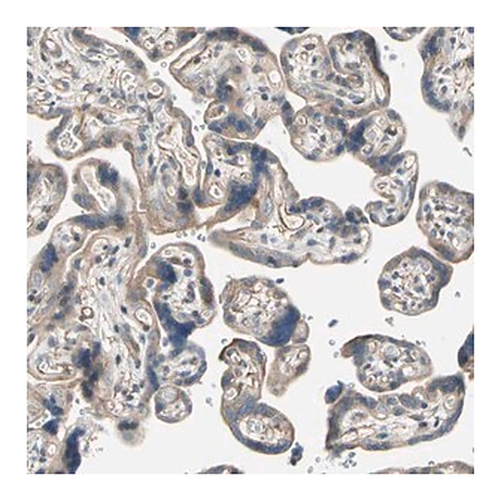 Merck Anti-LIMK2 antibody produced in rabbit