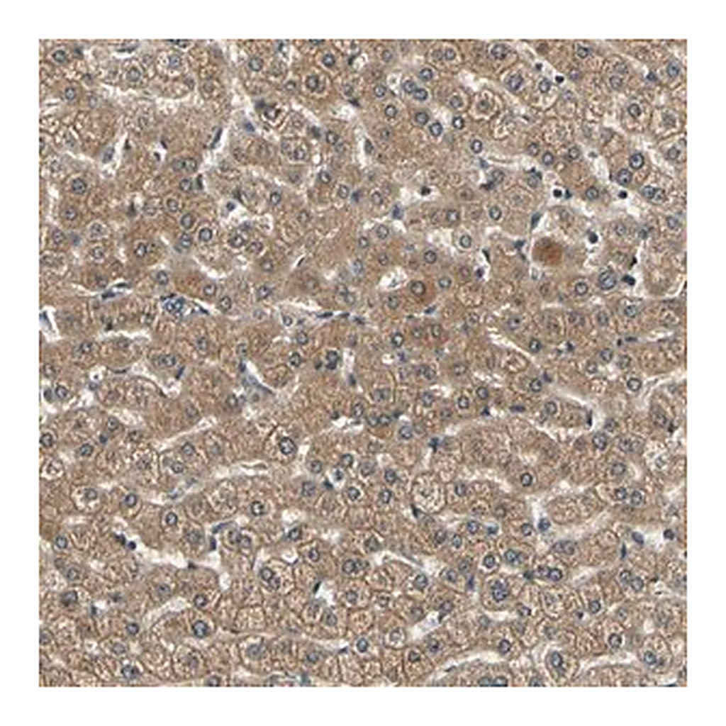 Merck Anti-LPGAT1 antibody produced in rabbit