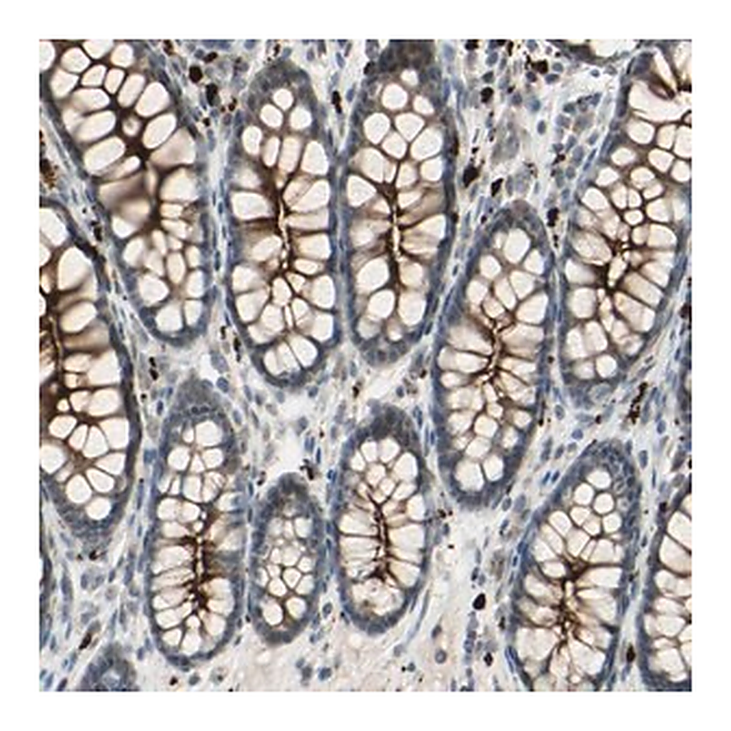 Merck Anti-LMTK2 antibody produced in rabbit