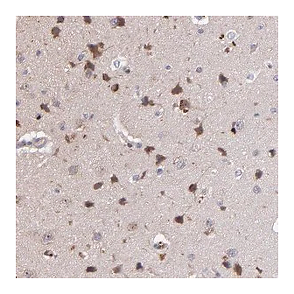 Merck Anti-MAGEE1 antibody produced in rabbit