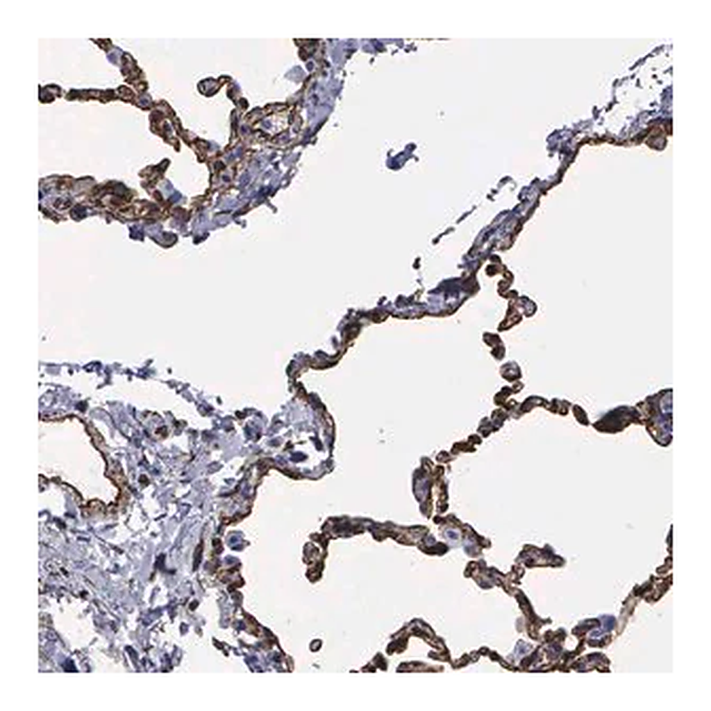 Merck Anti-MAGEB10 antibody produced in rabbit