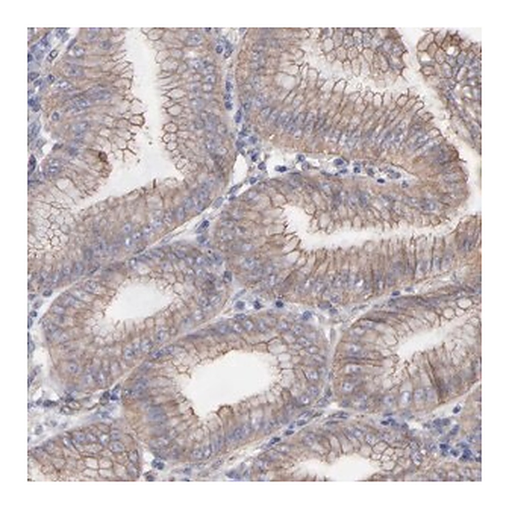 Merck Anti-LRCH2 antibody produced in rabbit