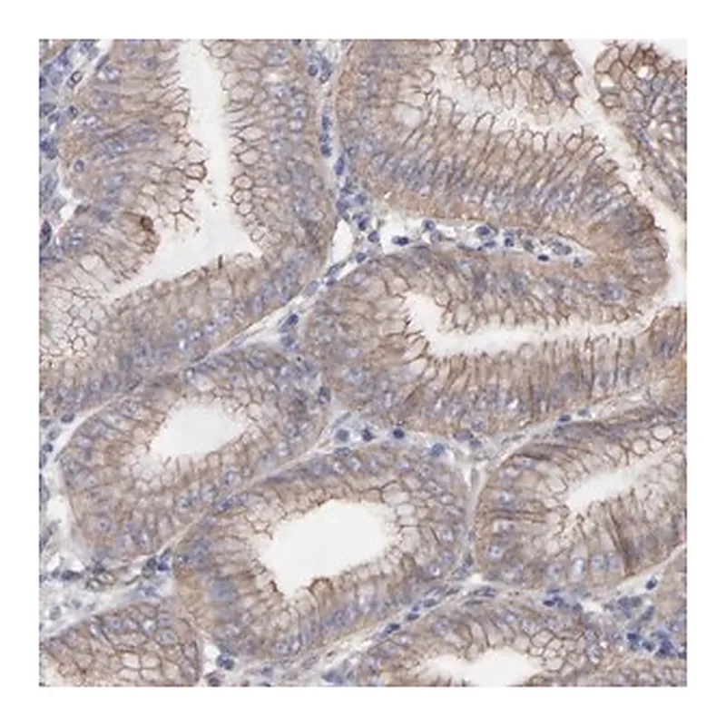Merck Anti-LRCH2 antibody produced in rabbit