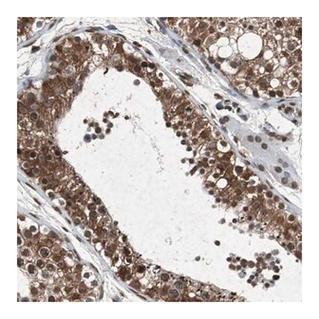 Merck Anti-SLC27A3 antibody produced in rabbit