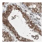 Merck Anti-SLC27A3 antibody produced in rabbit