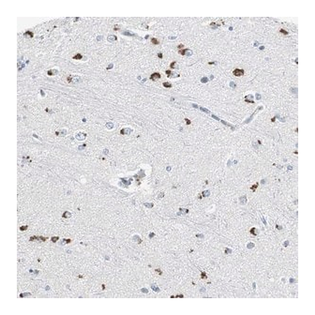 Merck Anti-SERPINF1 antibody produced in rabbit