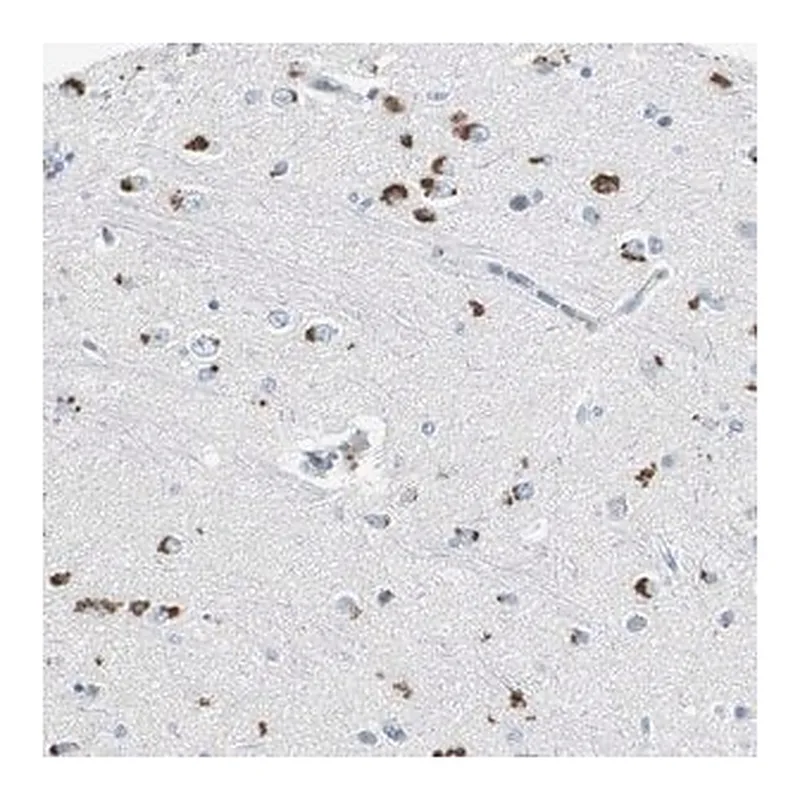 Merck Anti-SERPINF1 antibody produced in rabbit